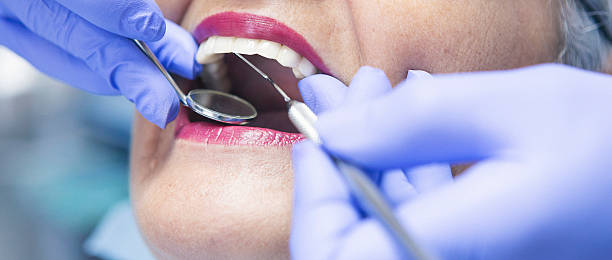 Best Emergency Treatment for Dental Infections or Abscesses in Springerville, AZ